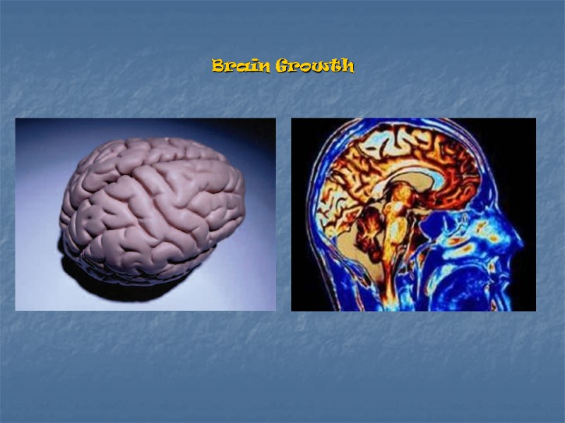 Brain Growth